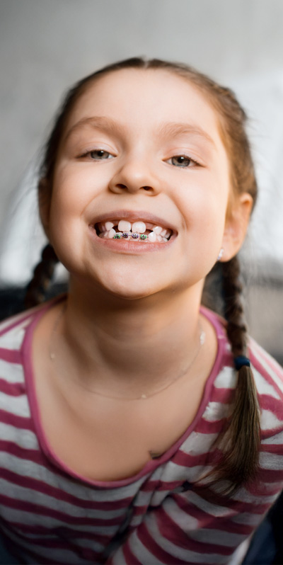 Treatment Interceptive Orthodontics